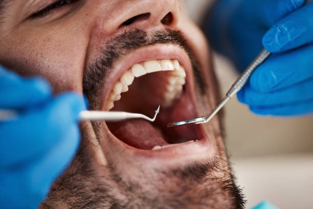 Best 24-Hour Emergency Dental Care in Wolf Lake, MI