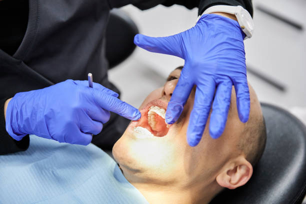 Best Emergency Root Canal Therapy in Wolf Lake, MI